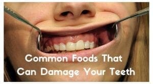 foods damage teeth